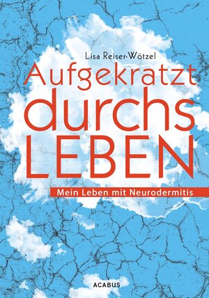 Buchcover Aufgekratzt durchs Leben. Mein Leben mit Neurodermitis | Lisa Reiser-Wötzel | EAN 9783862823062 | ISBN 3-86282-306-7 | ISBN 978-3-86282-306-2
